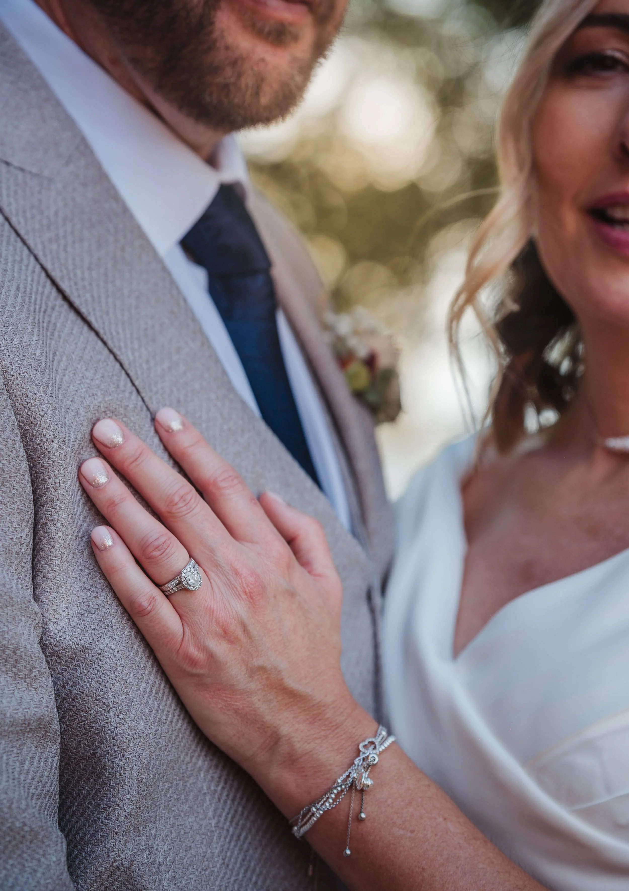 Close-up of a woman with manicured nails and wearing a wedding ring, resting her hand on a man's chest, with a blurred background of trees and sunlight.