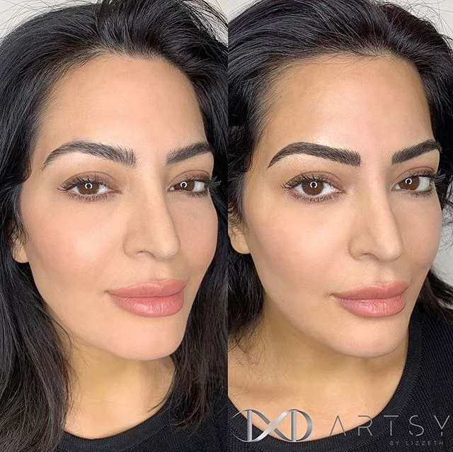 Can we just take a minute for this gorgeous face and brows #zoomin @stylesbynegar ❤️😍
.
Before: Brows previously done by a different artist.
After: Slayed by Lizzeth @nenalg 👩🏻&zwj;🎨
.
✦🖋 TECHNIQUE: #Microblading ✦⏱ TIME: 2 hours😴
✦ ANESTHETIC: