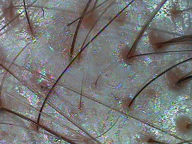 What inflammation looks like up close