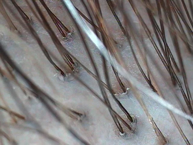 Healthy hair and scalp