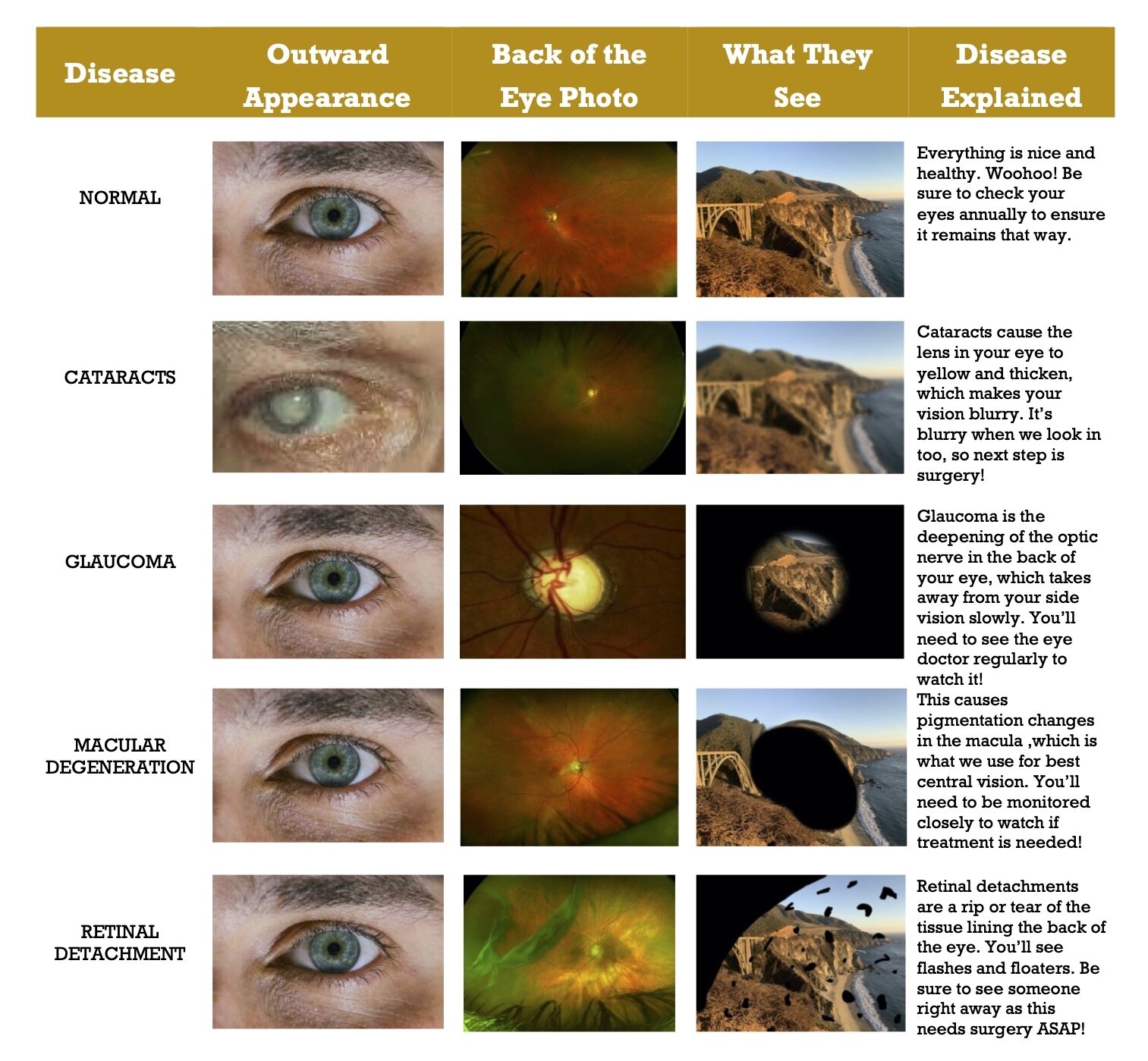 case study of eye disease