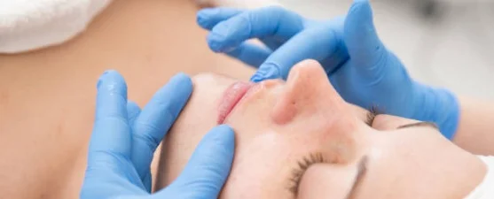 Filler til tynde læber: hvordan opnår du naturlig volumen?