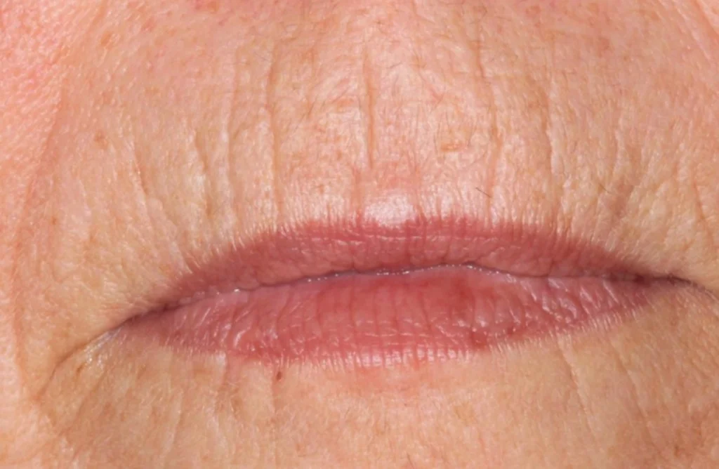 rynkebehandling_0001-1024x668.jpg