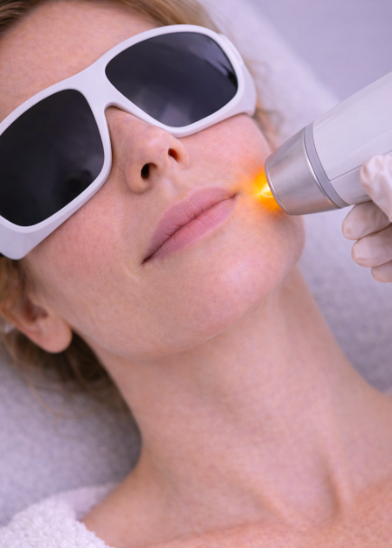 Laserbehandling af hud: Sådan forbedrer det din hudkvalitet