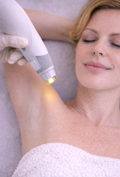 Laser hårfjerning i armhulerne: Permanent glathed uden besvær