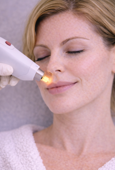 Laser mod karsprængninger: Effektiv behandling uden nedetid