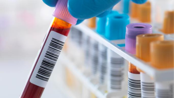 The Times: Photographic exhibition PhotoVoice focuses on living with HIV