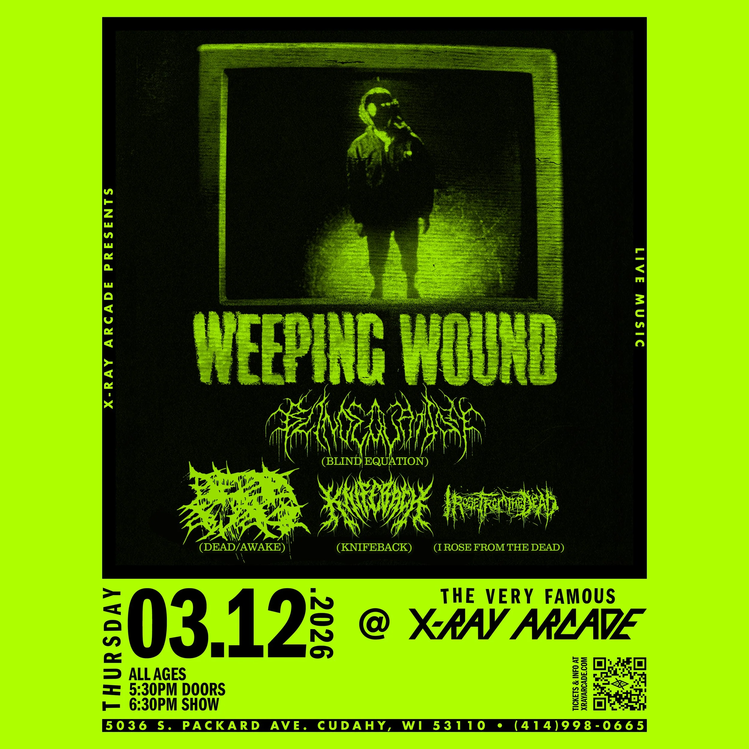Weeping Wound / Blind Equation / Dead/Awake / Knifeback / I Rose From the Dead