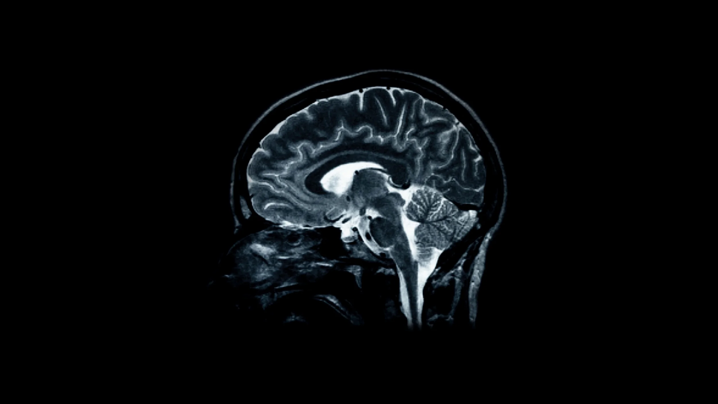 brainscan.jpg