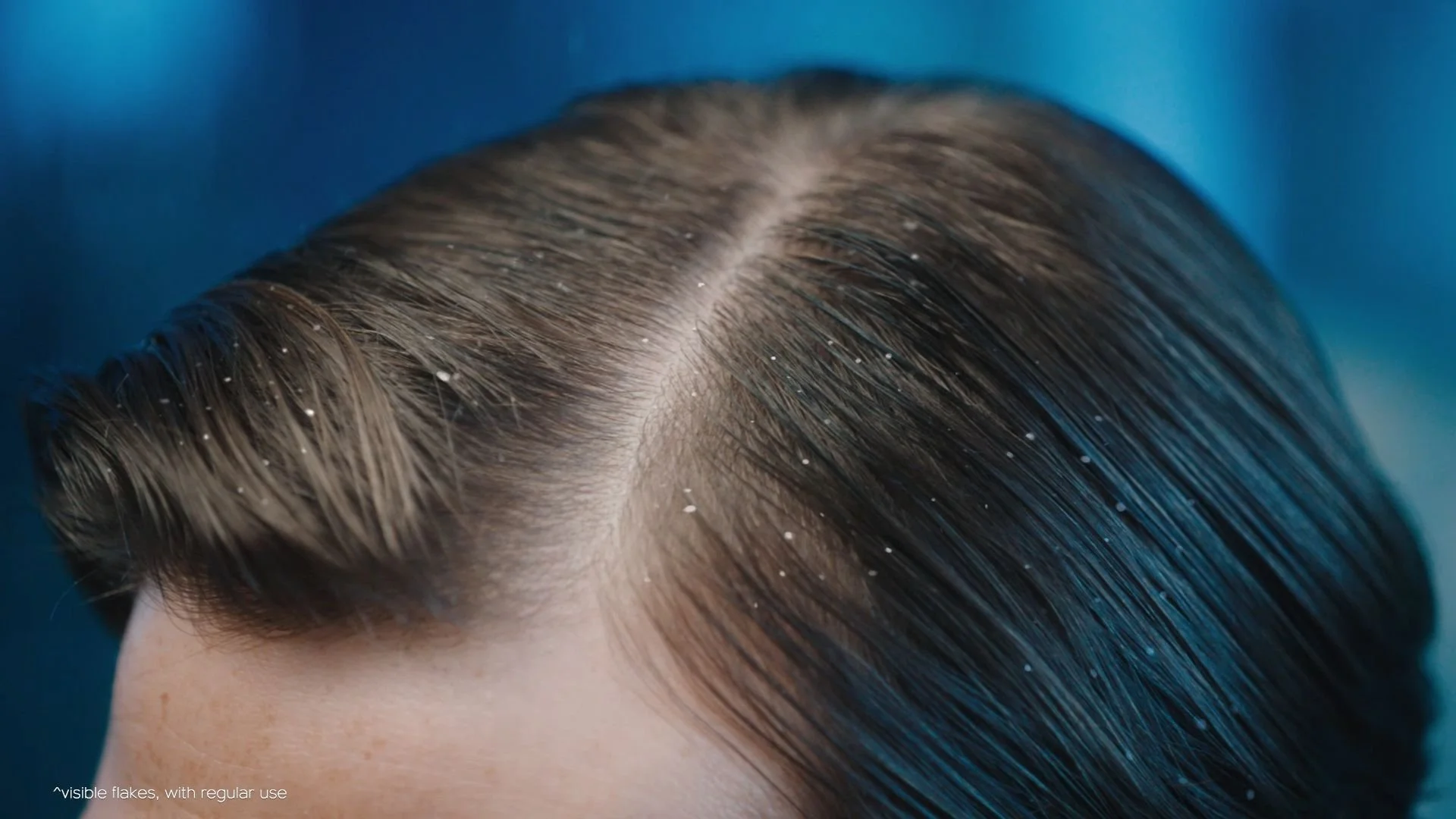 Head & Shoulders_Ultramen_Cutdown_30