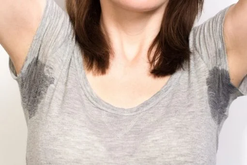 What is hyperhidrosis?