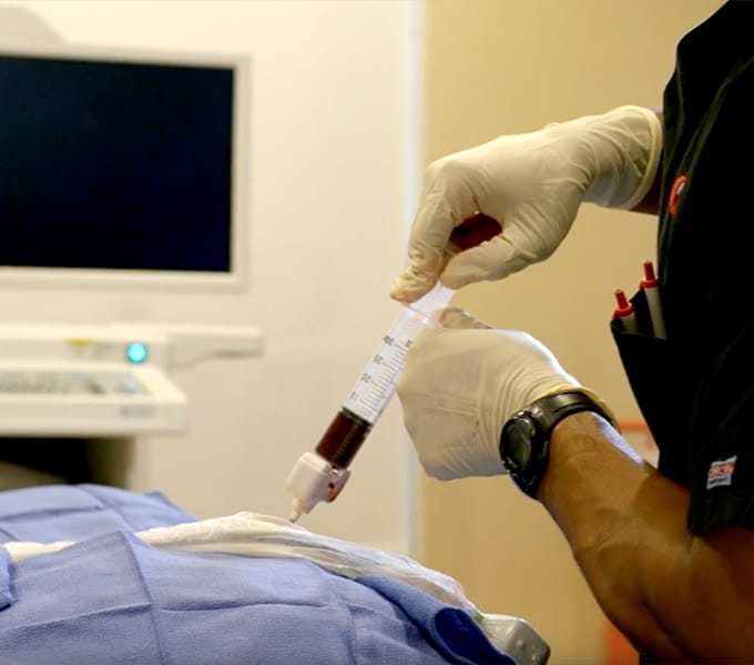regenexx-experience-second-day-stem-cell-procedure.jpg