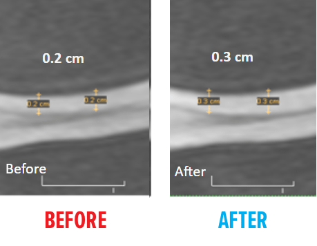 knee-msc-mri-before-after1.png