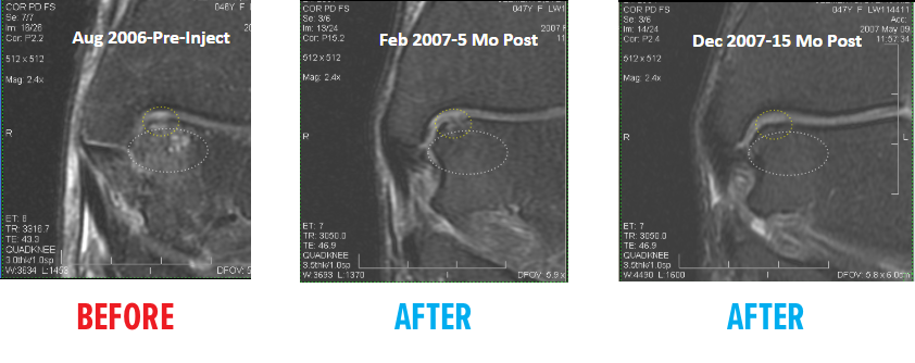 foot-ankle-mri1.png