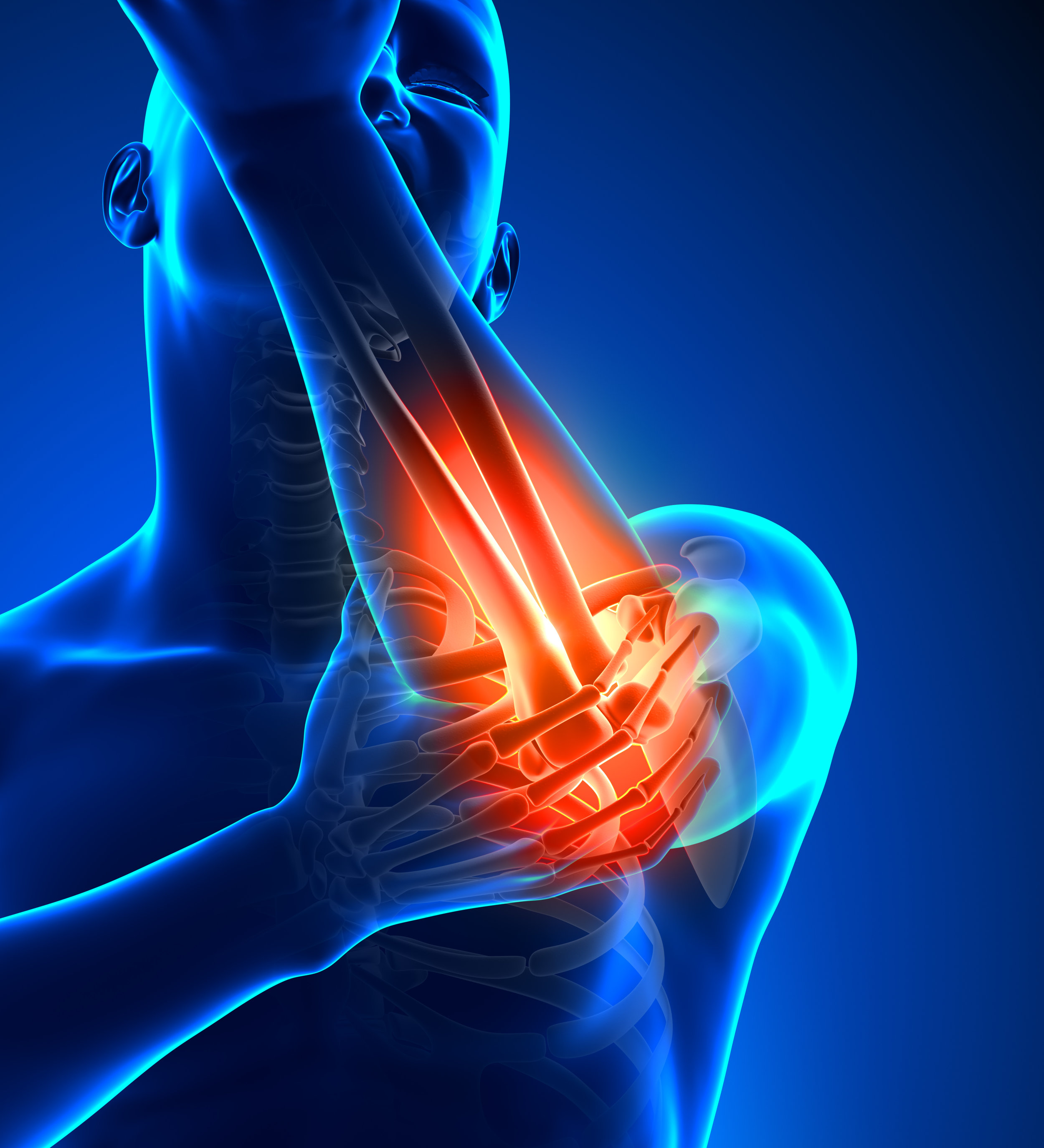 Elbow Patient Outcomes.