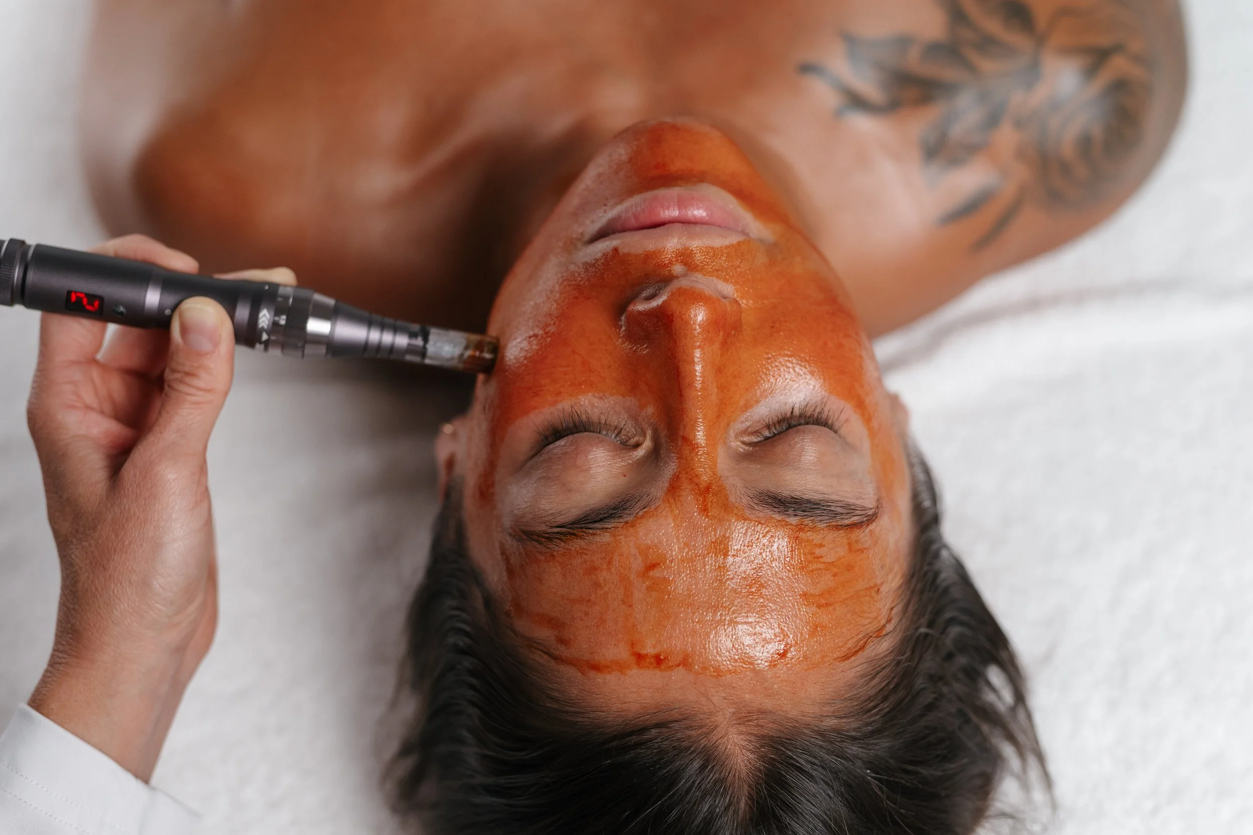 ReVitaPen Facial Infusion in Knoxville, TN