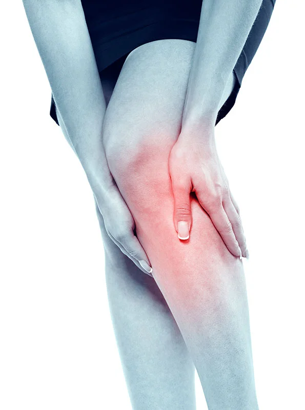 VARICOSE VEINS.jpg
