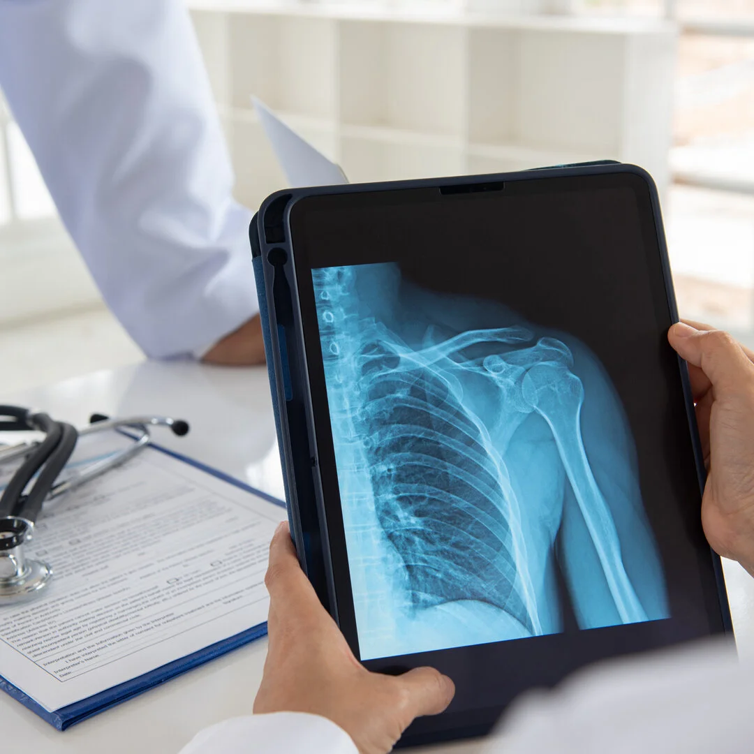 The First Step Toward Arthritis Relief is an Accurate Diagnosis