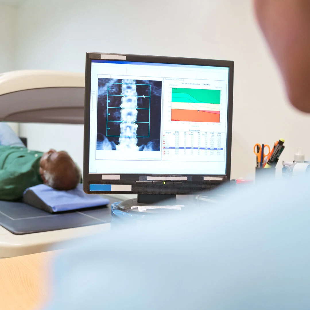RAD to the Bone – DEXA Bone Density Testing