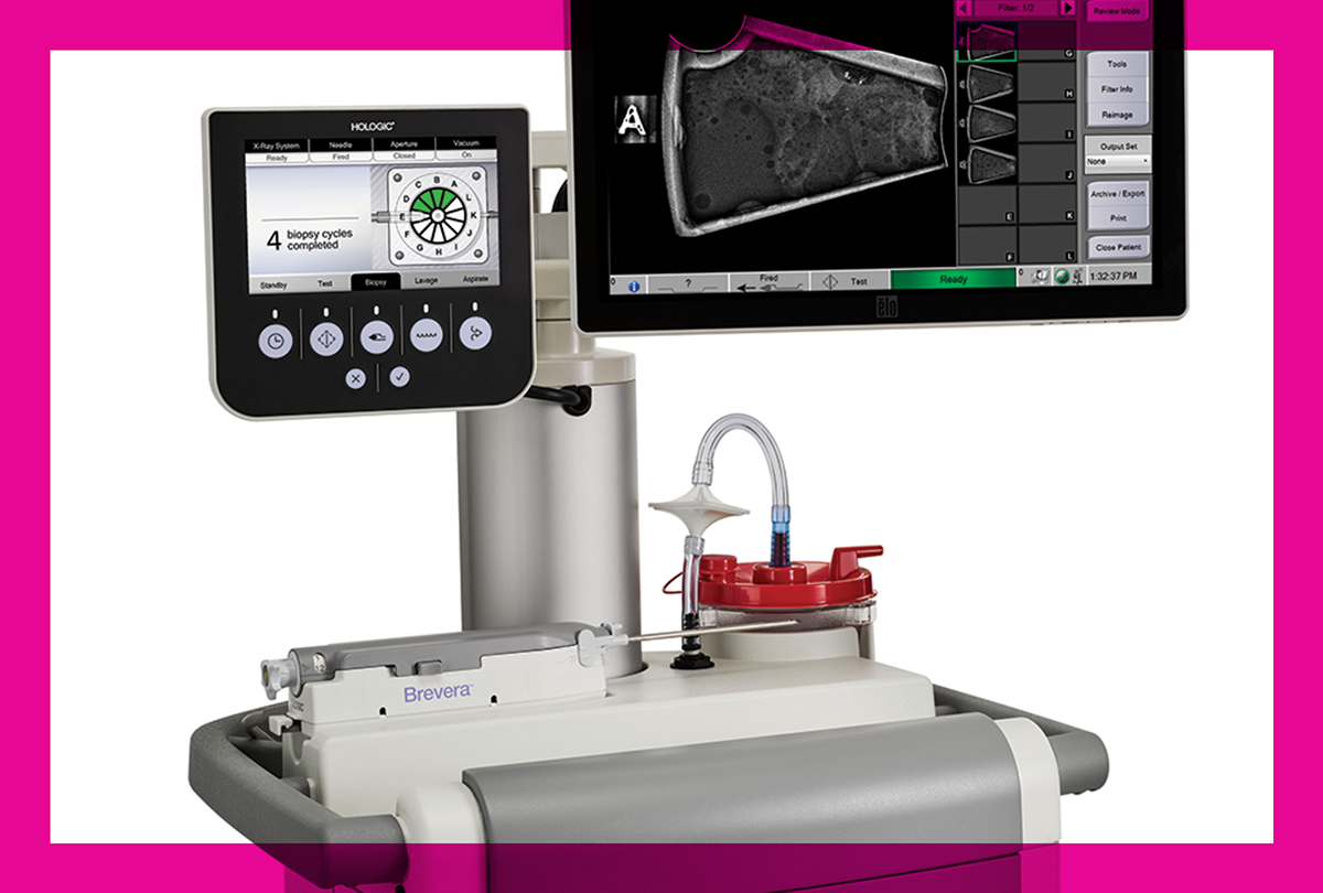 Stereotactic Breast Biopsy Radiology Associates of Ocala — Radiology