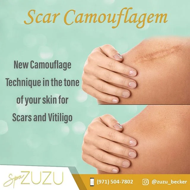 As scars heal, they go through several color changes. Scars, whether fully healed or in a stage of healing, may also be depressed or raised, shiny, or rough in appearance. Skin conditions such as vitiligo can also give you a &ldquo;patchy&rdquo; appe