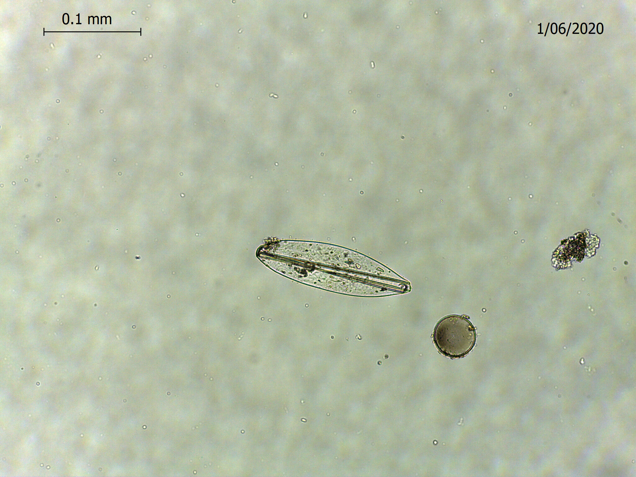  Plankton found off White Bluff. For the full story see our news page here: https://www.thewhitebluffproject.co/news/2021/1/16/rare-find-inspires-art-project 