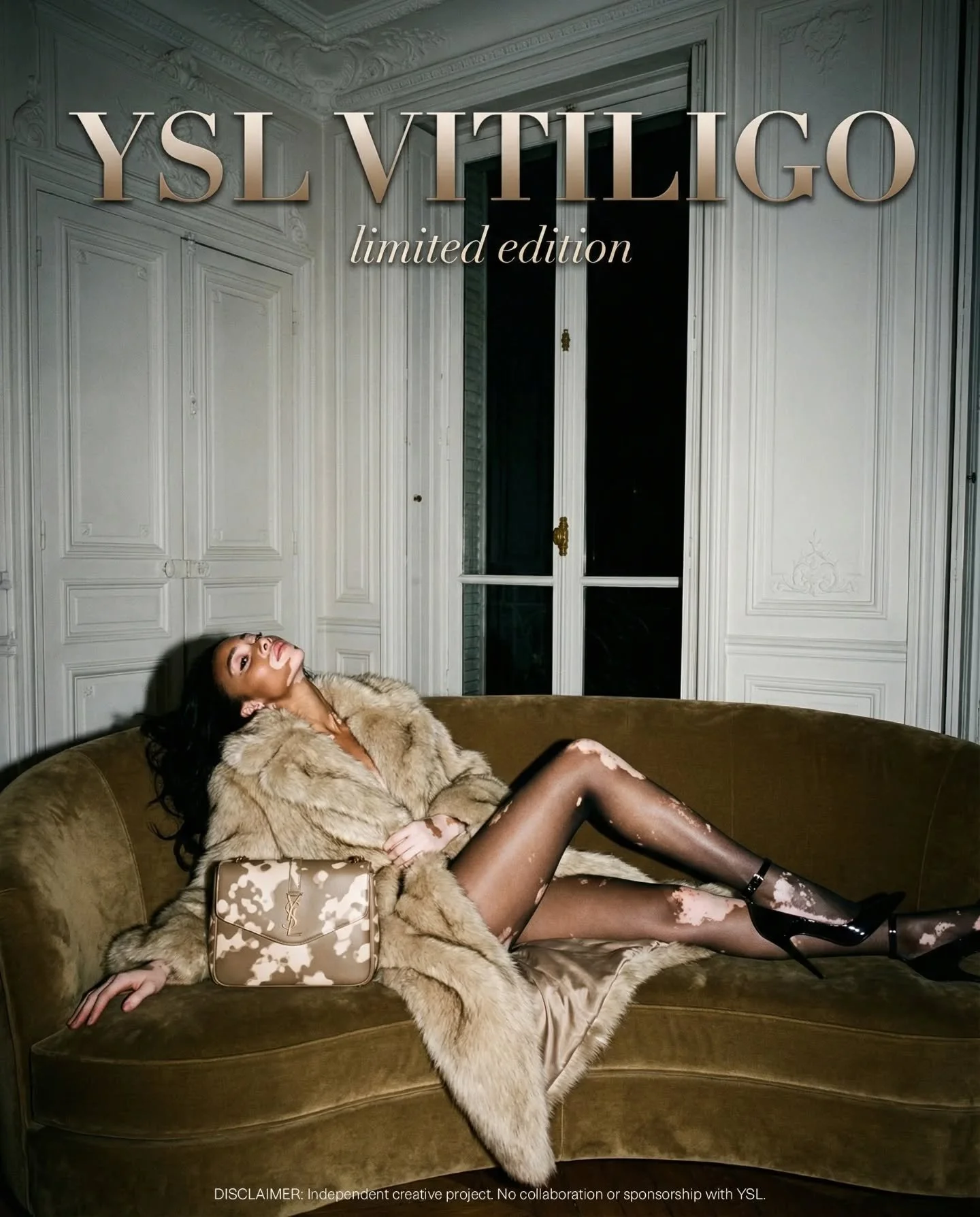 Vitiligo is beautiful and deserves to be seen.

I created a YSL‑style showcase campaign where the skin pattern is a natural part of the image, not hidden or explained. 

From idea to final series in one creative Sunday: editorial mood, hyper‑real AI 