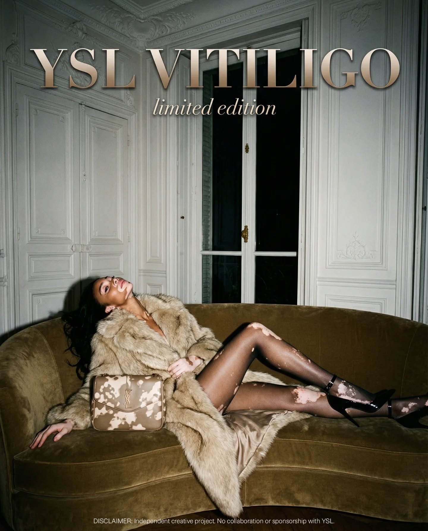 Vitiligo is beautiful and deserves to be seen.

I created a YSL‑style showcase campaign where the skin pattern is a natural part of the image, not hidden or explained. 

From idea to final series in one creative Sunday: editorial mood, hyper‑real AI 
