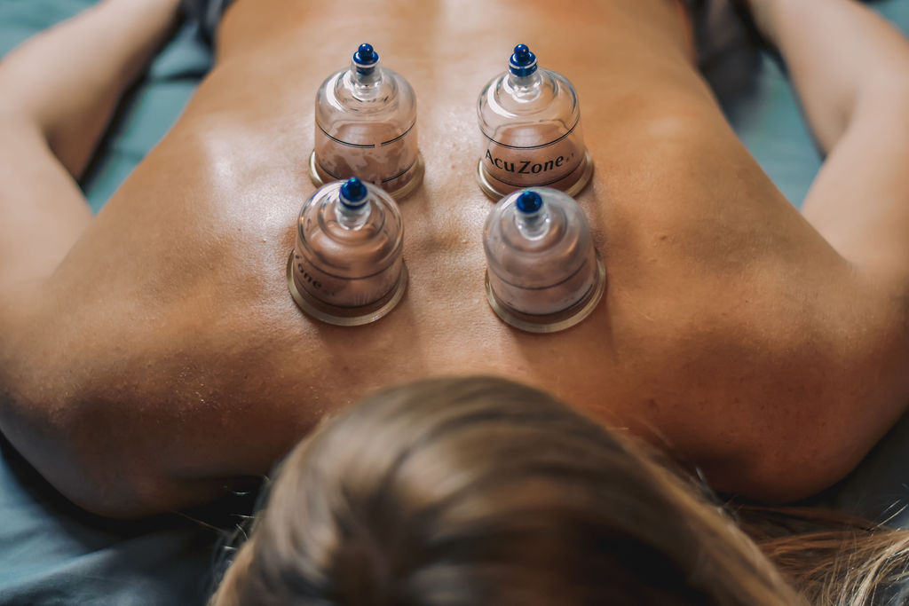 Cupping Therapy 