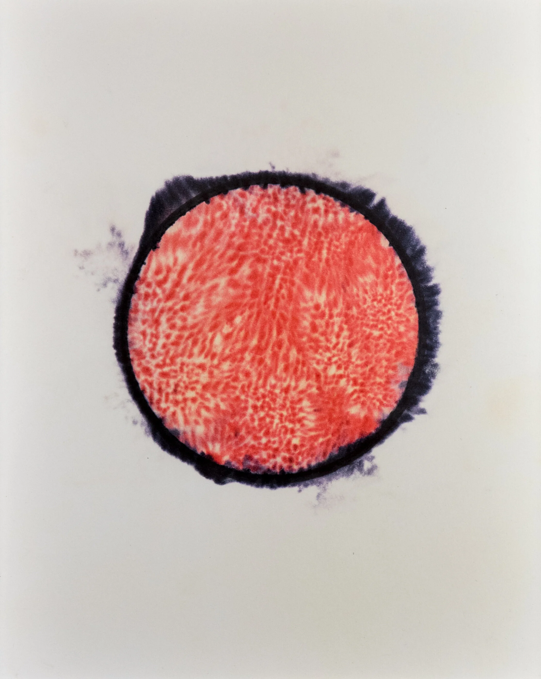 Matthew Gallagher - Sunshine