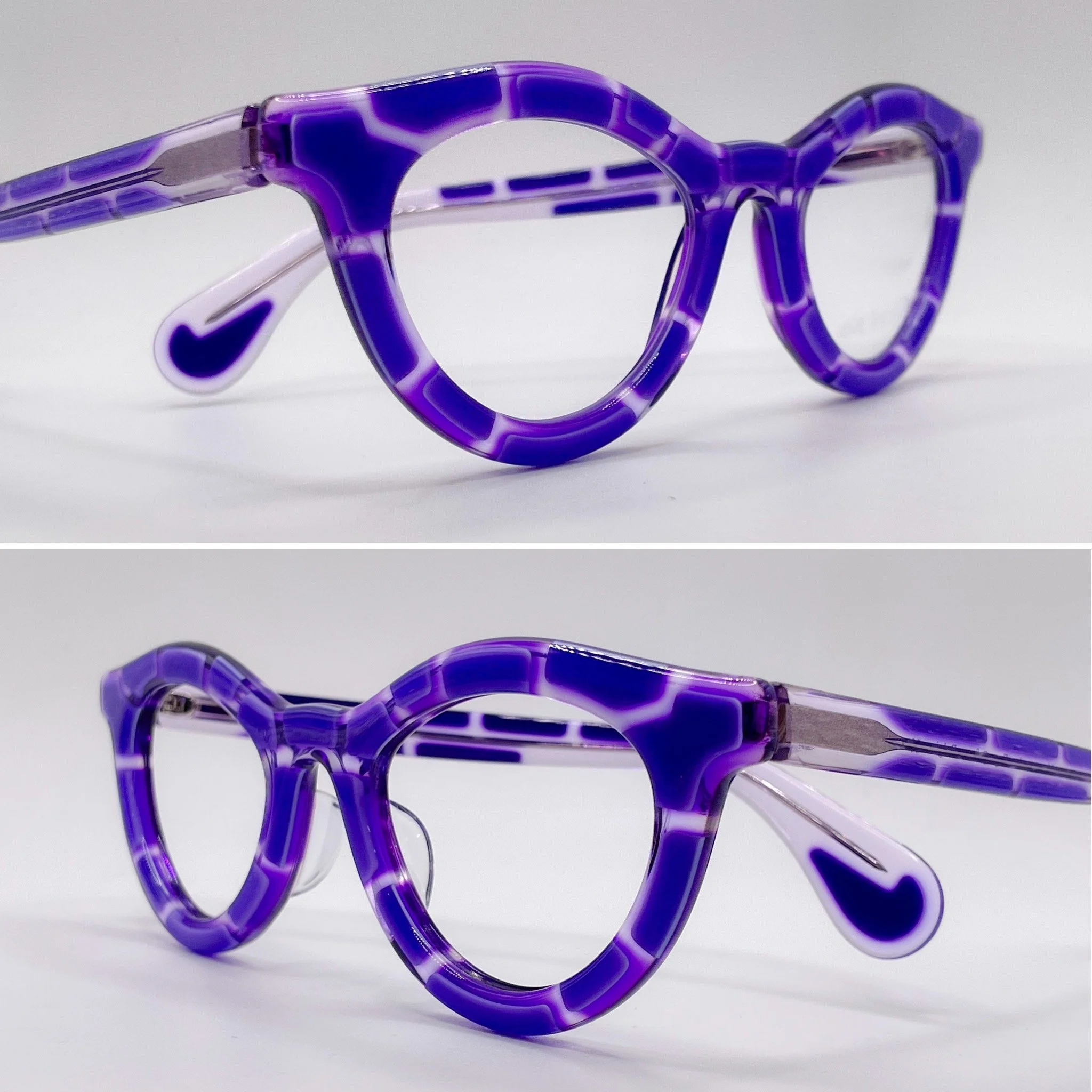 large acetate build up - Theo