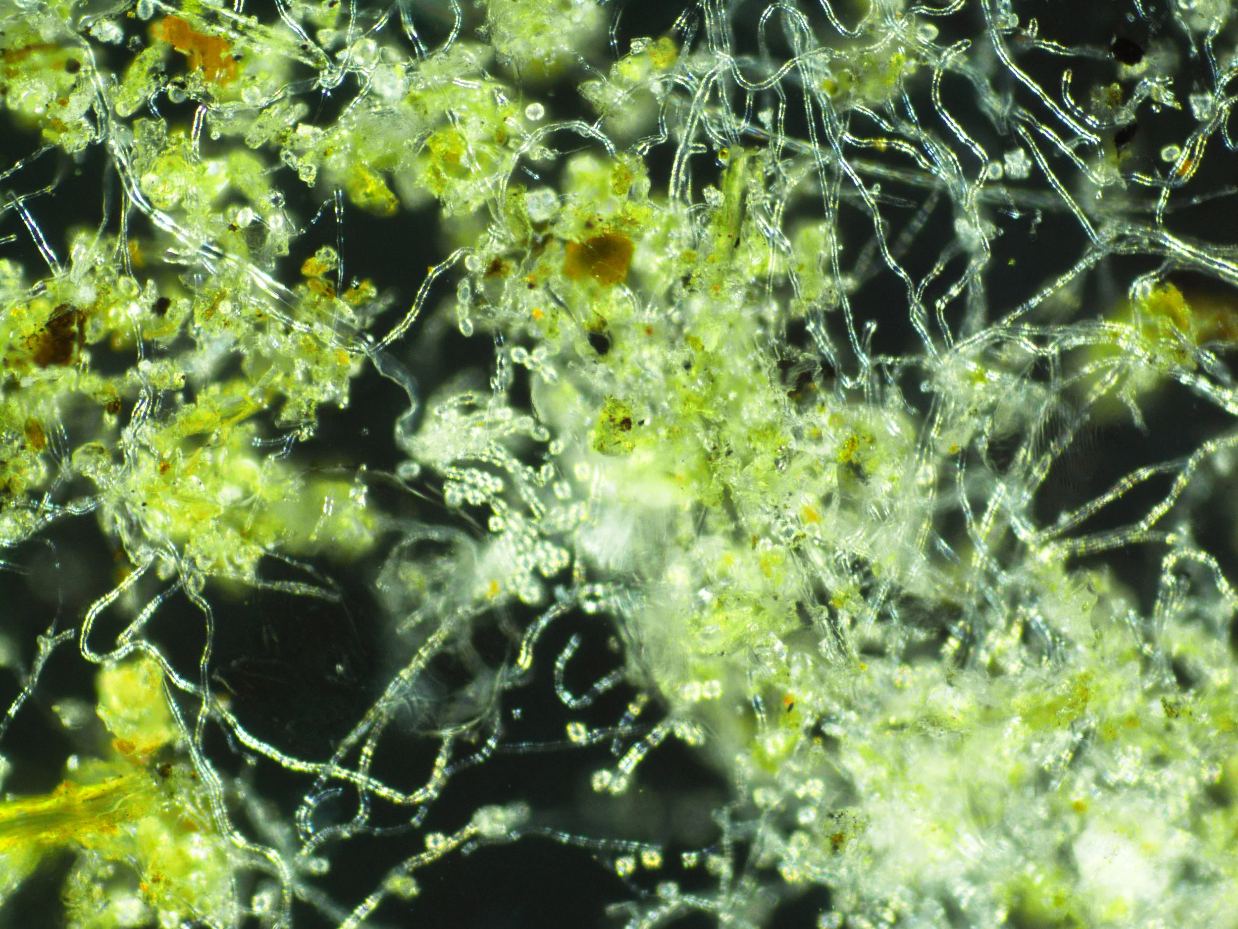 Microscopic photograph of the fungi