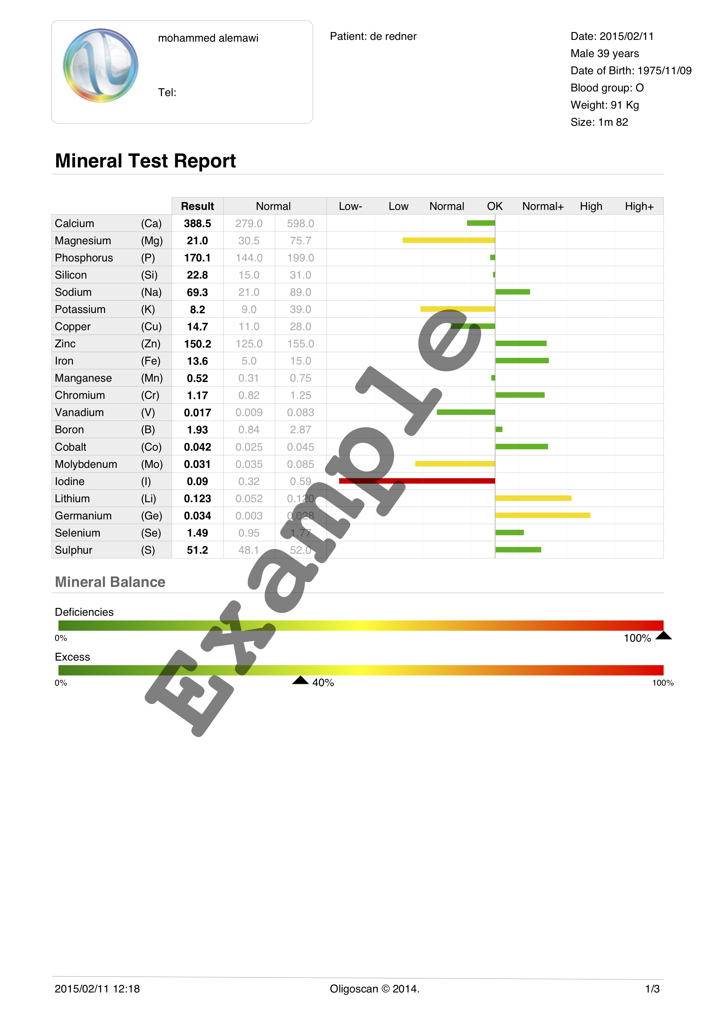 Oligoscan Test sample 1.png