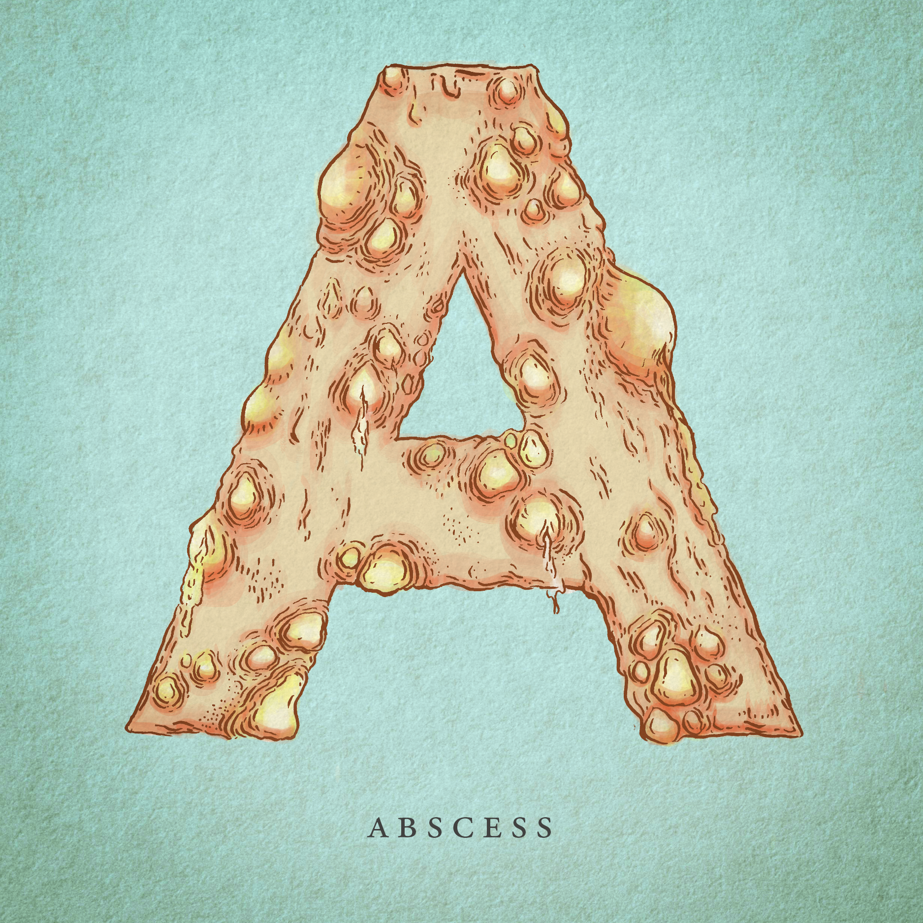 Abscess.png
