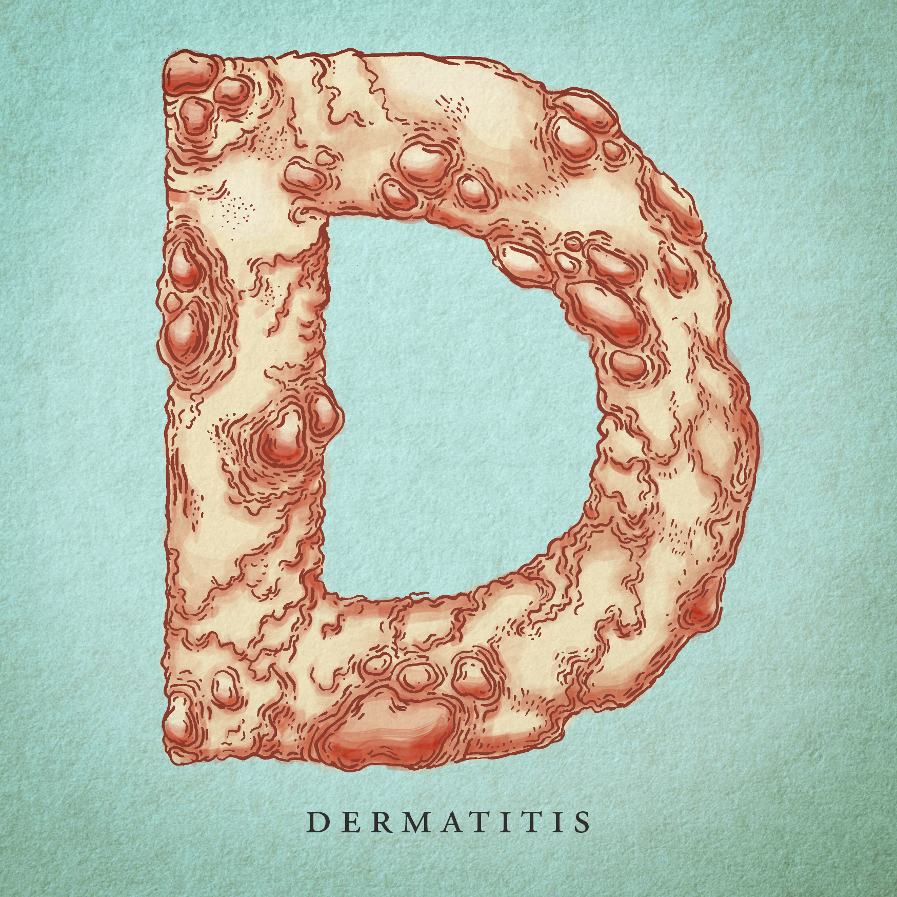 Dermatitis.png