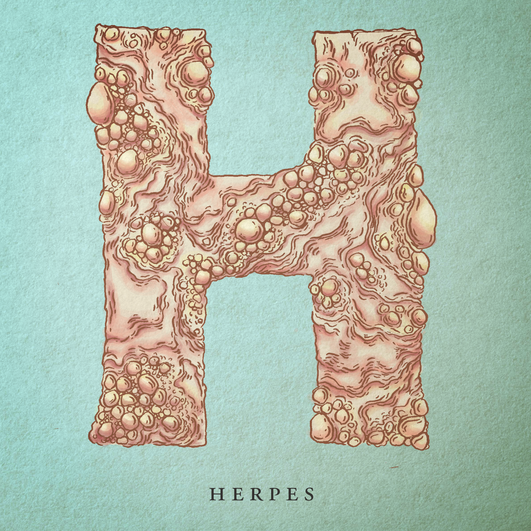 Herpes.png