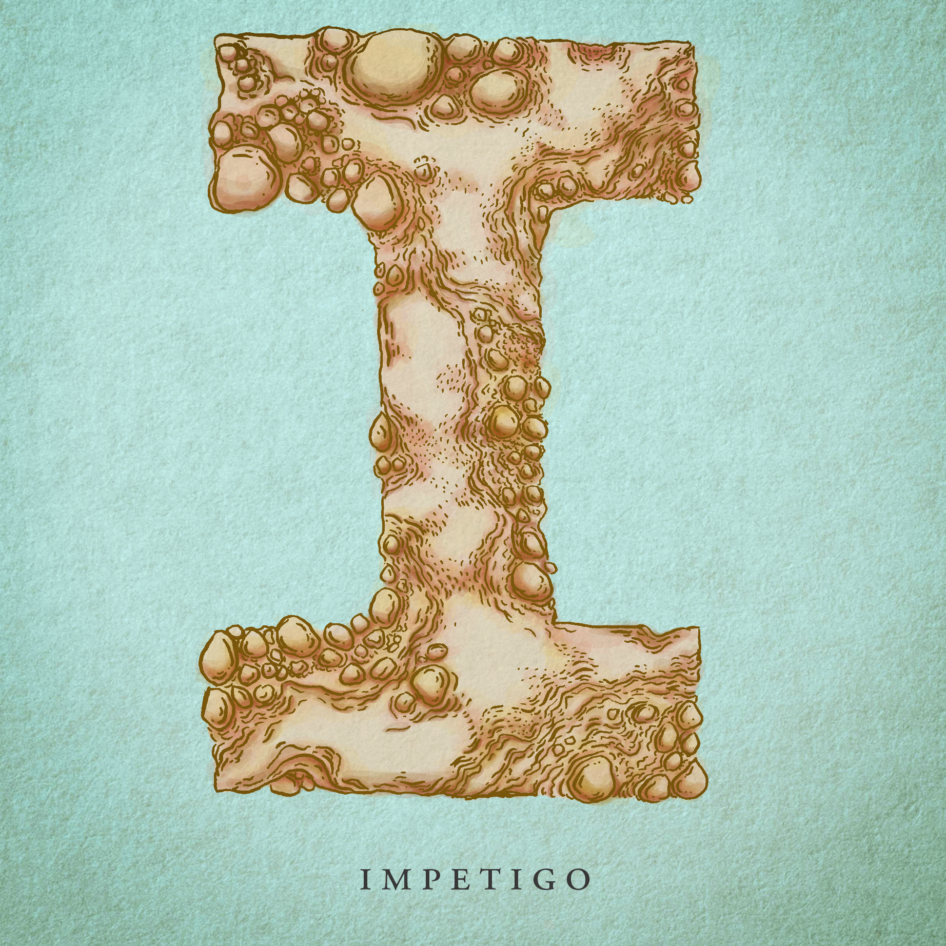 Impetigo.png
