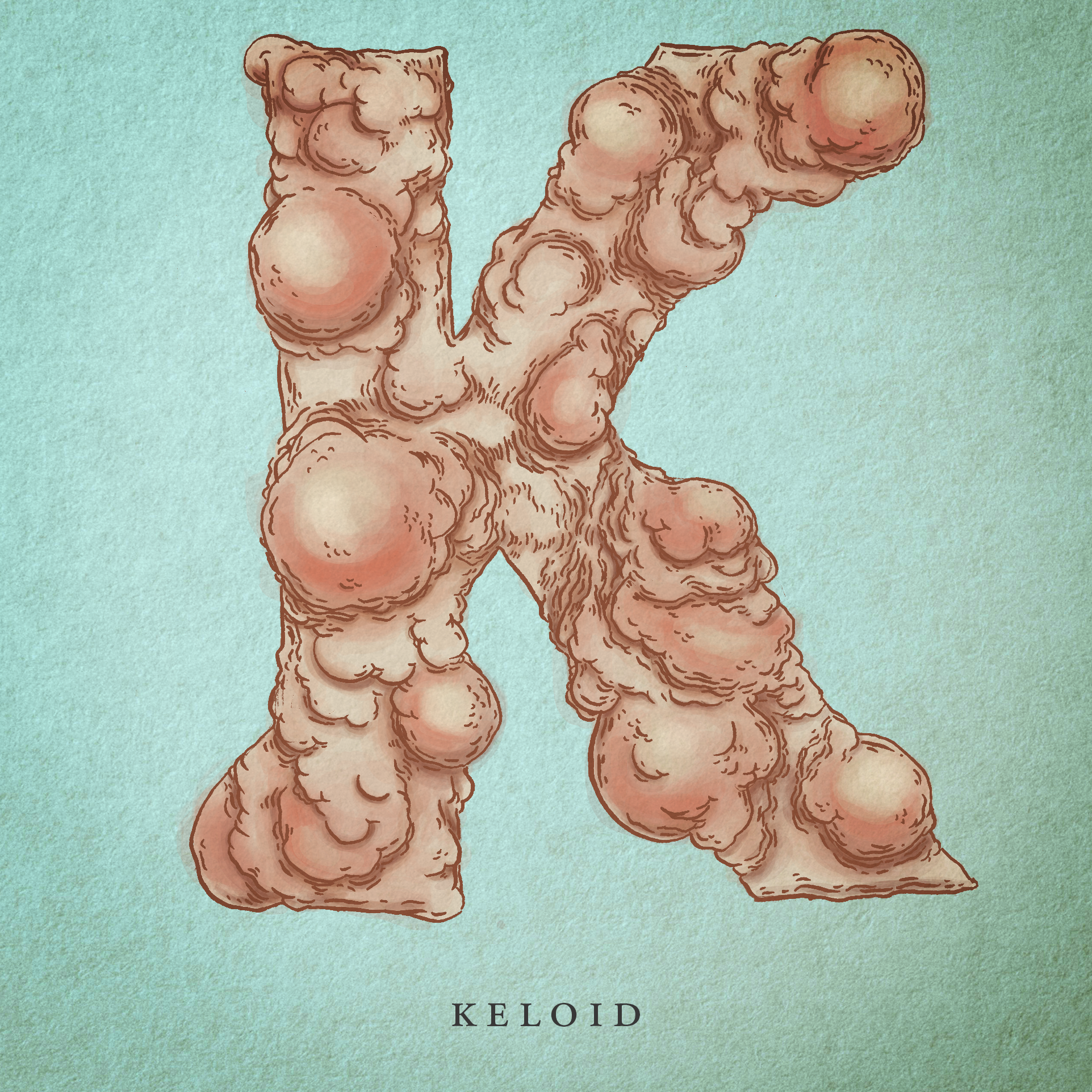 Keloid.png