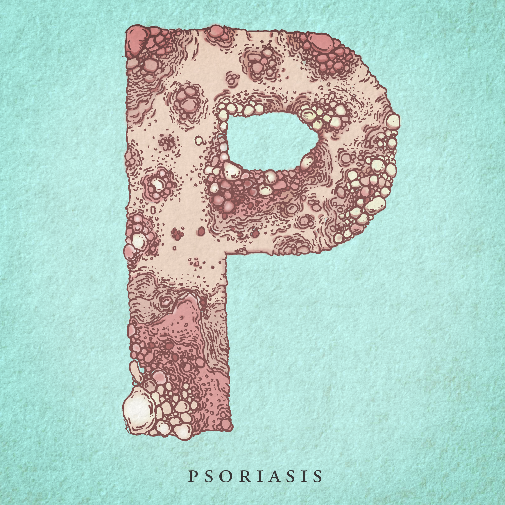Psoriasis.png