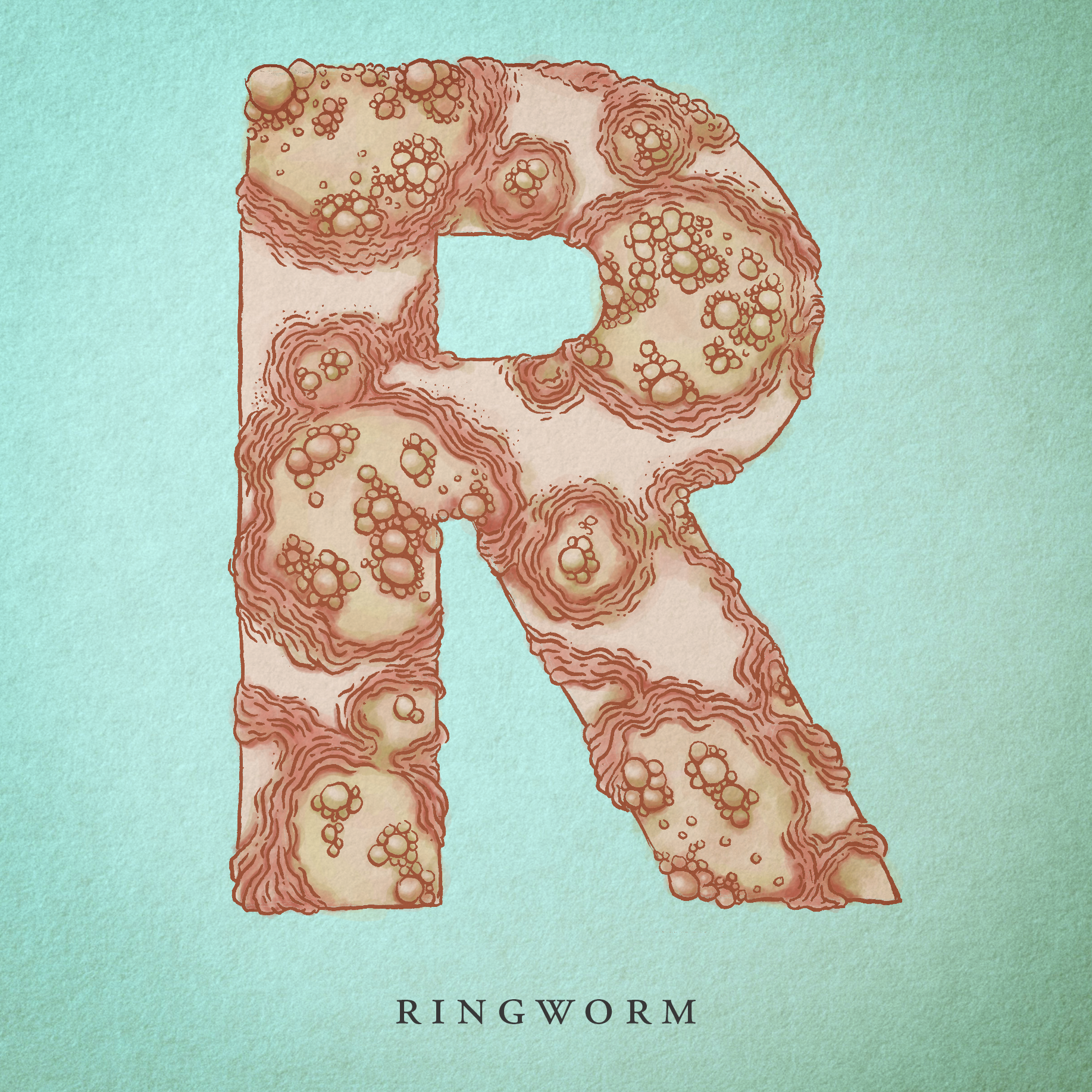 RIngworm.png