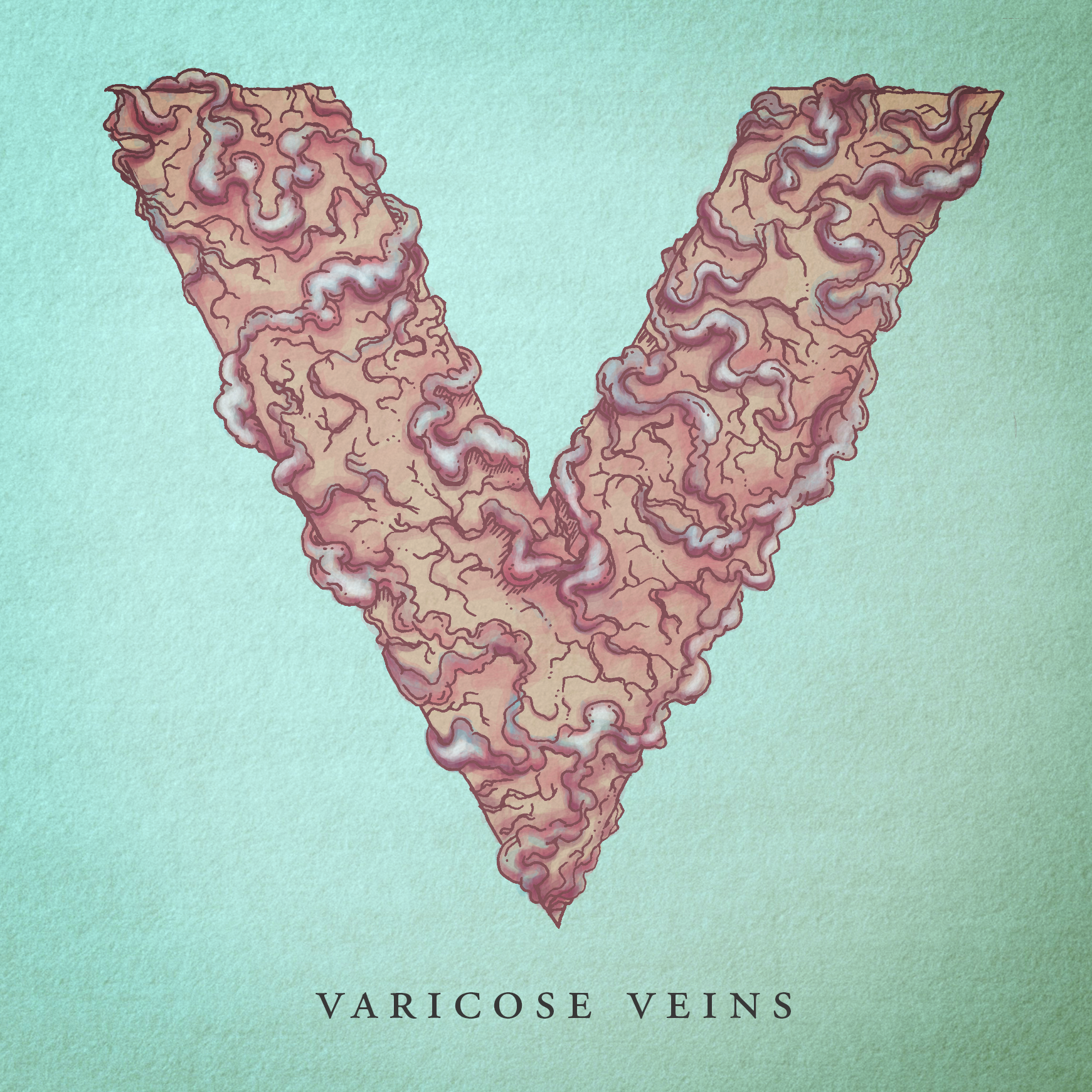 Varicose Veins.png