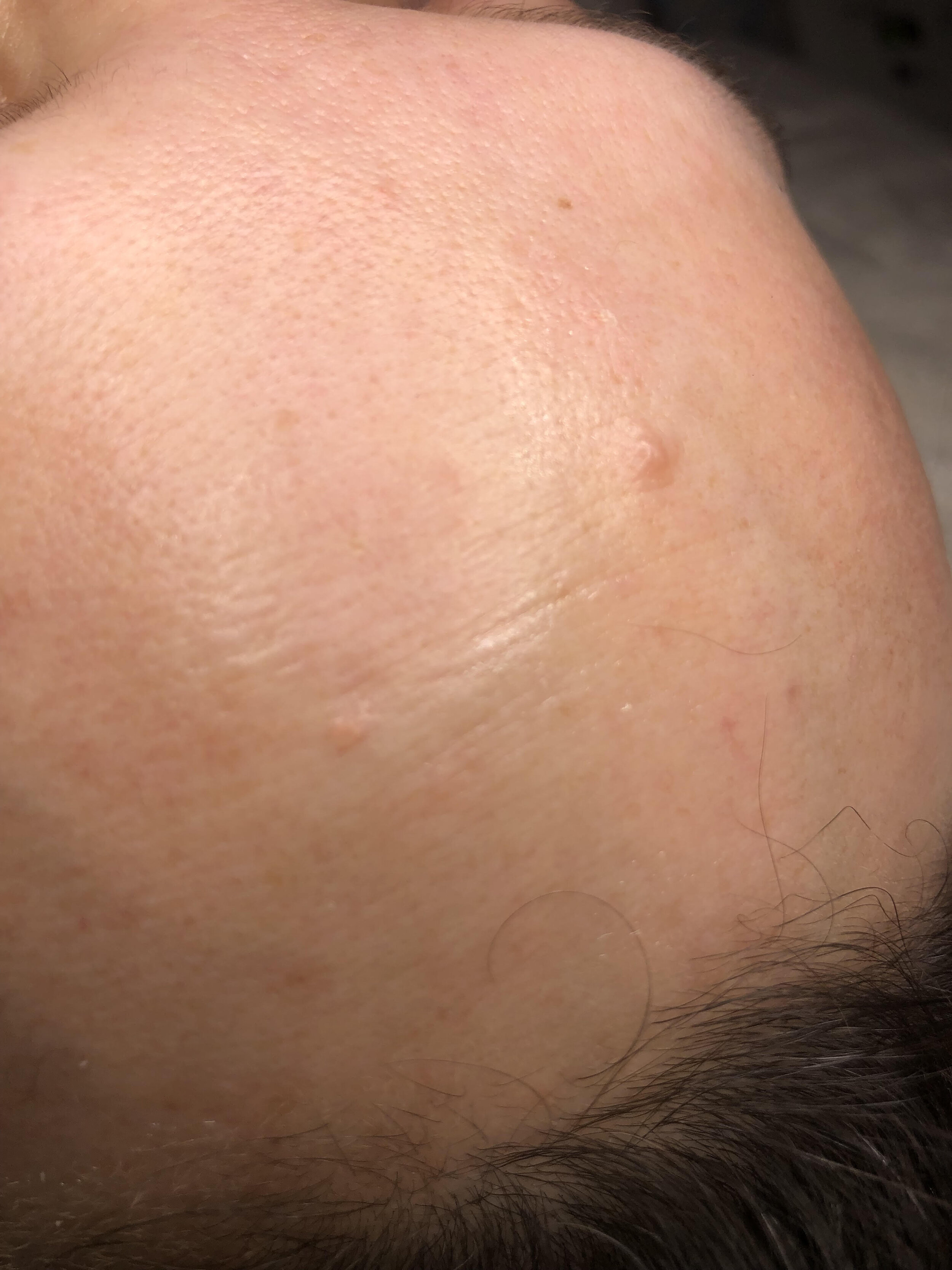 skin classic .jpg
