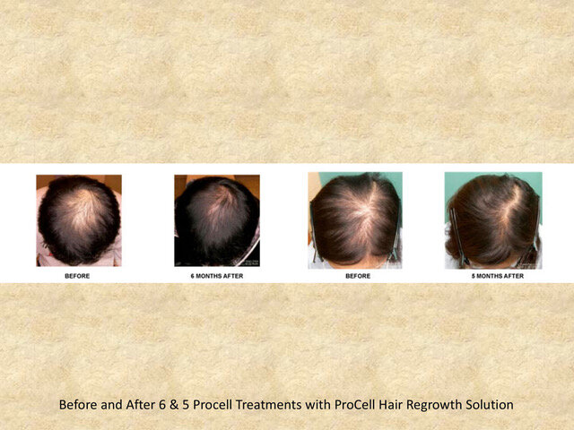 010ProCellBeforeAndAfter-1-08.jpeg
