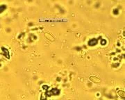 Ceranae at 400X under a Microscope. Courtesy The Animal and Plant Health Agency (APHA), Crown Copyright