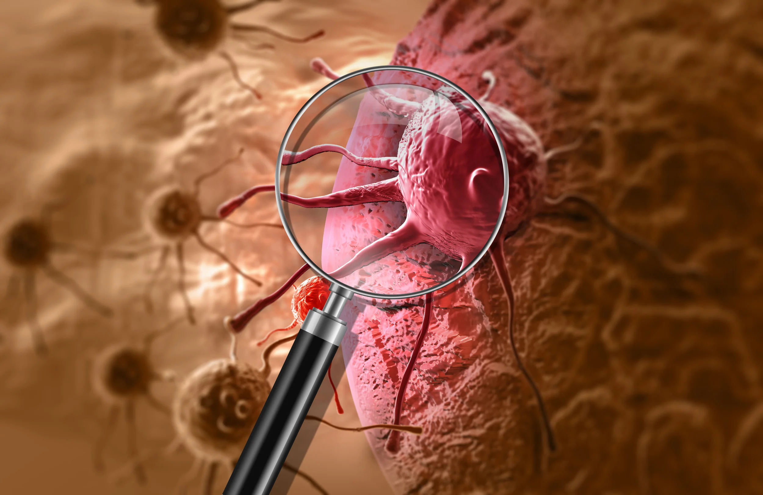 What Are Deadly Cancers? — DEADLIEST CANCERS COALITION
