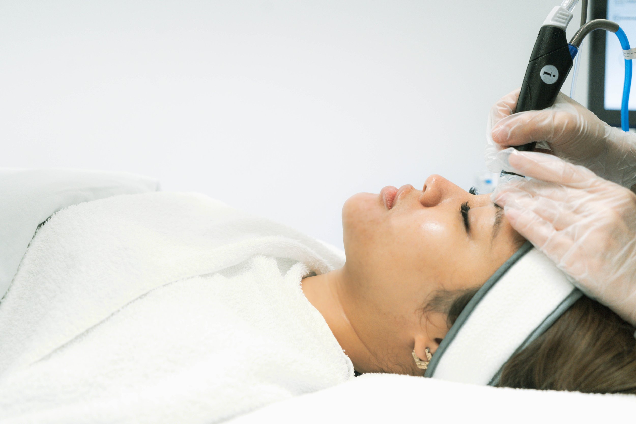 Hydrafacial-Maria-Smoothed out skin.jpg