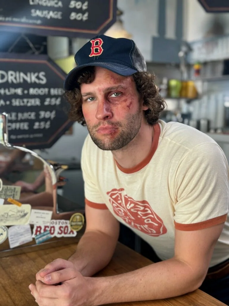 joe burns - bruise pizza guy.JPG