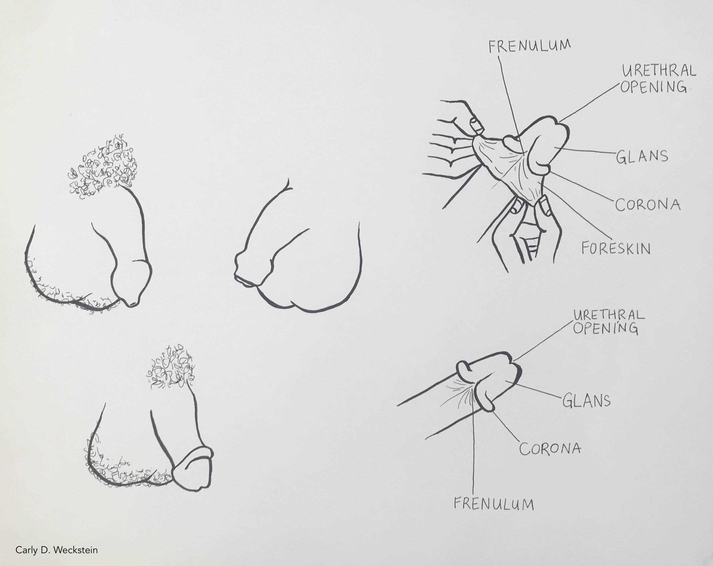 penis foreskin and circumsized.jpg