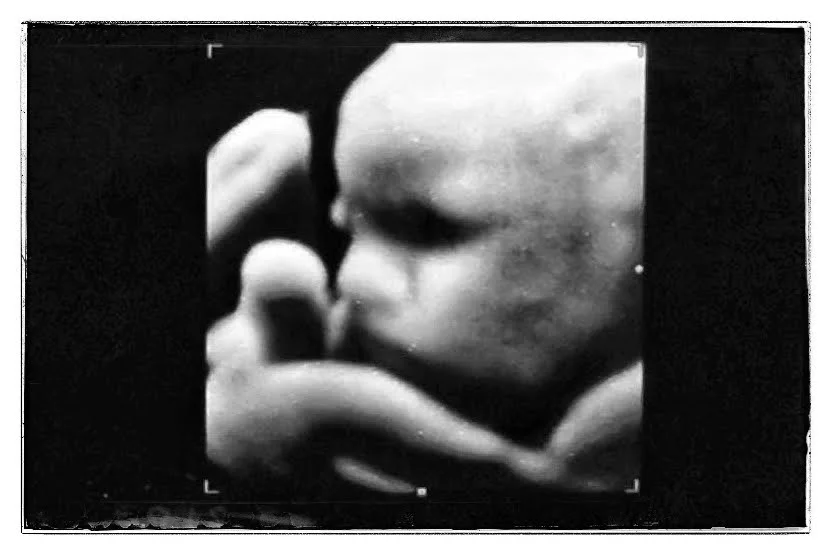 22jan19 IVultraSound01-02.jpeg