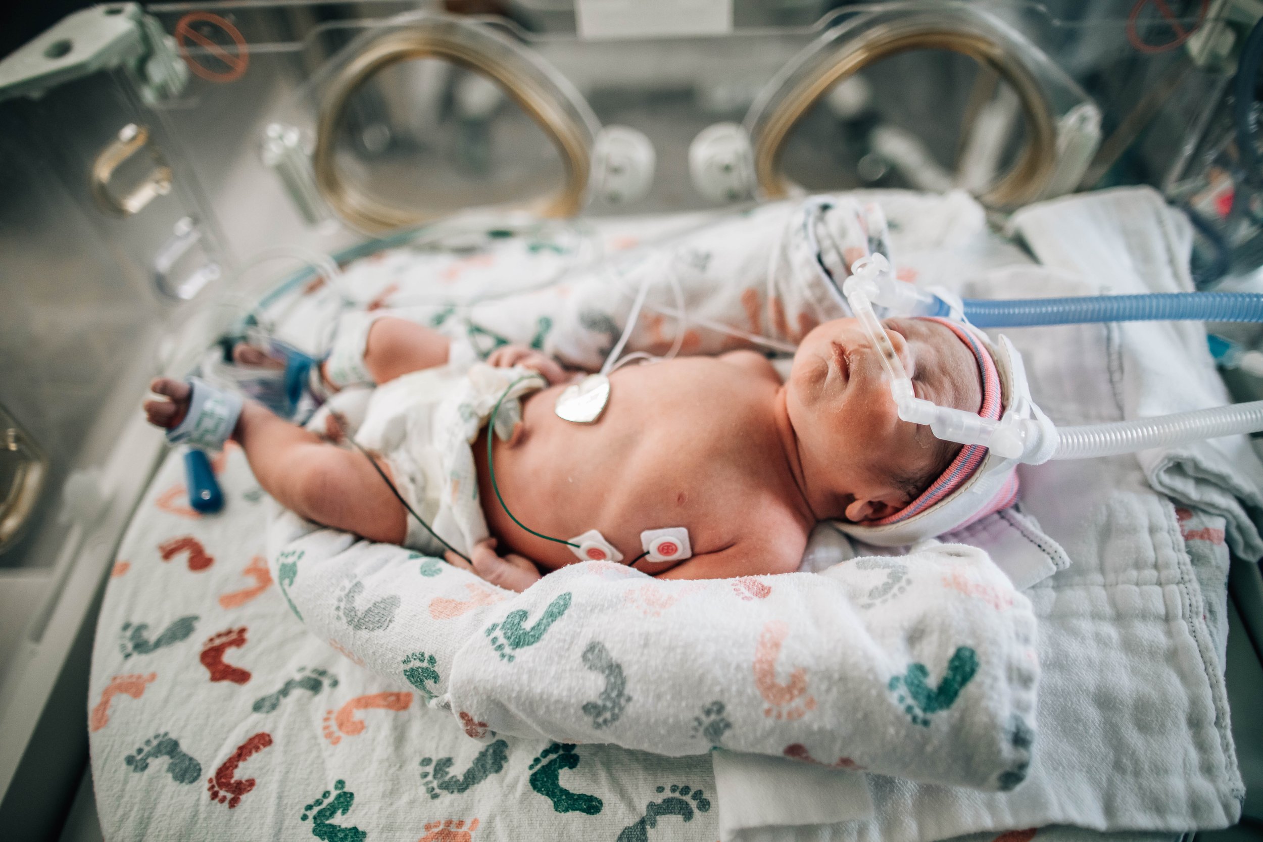 Newborn baby lying in neonatal incubator with medical tubes, monitors, and a hat with red and blue stripes.
